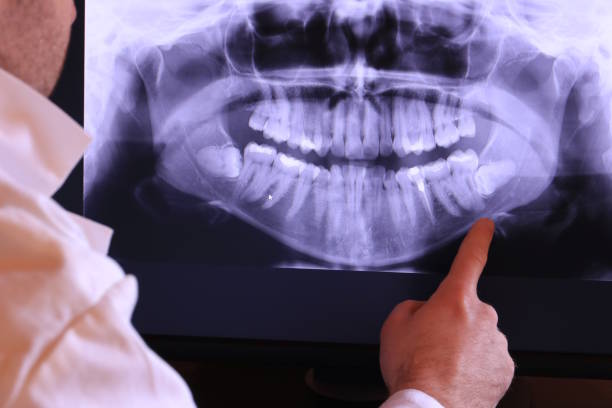 Best Emergency Dentist for Knocked-Out Tooth in El Dorado, KS